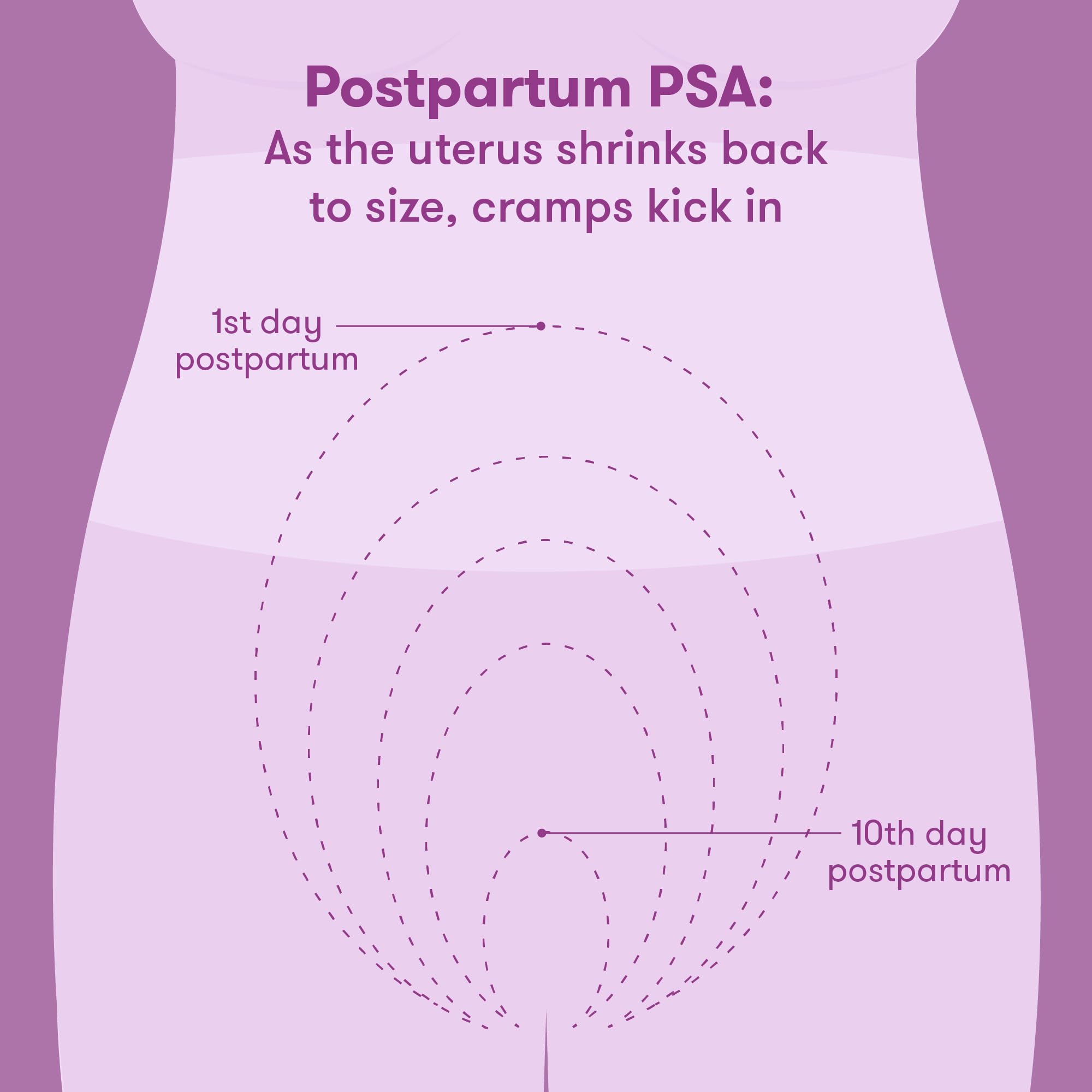 Unmedicated uterine recovery heating pads applied to briefs for hands-free abdominal relief