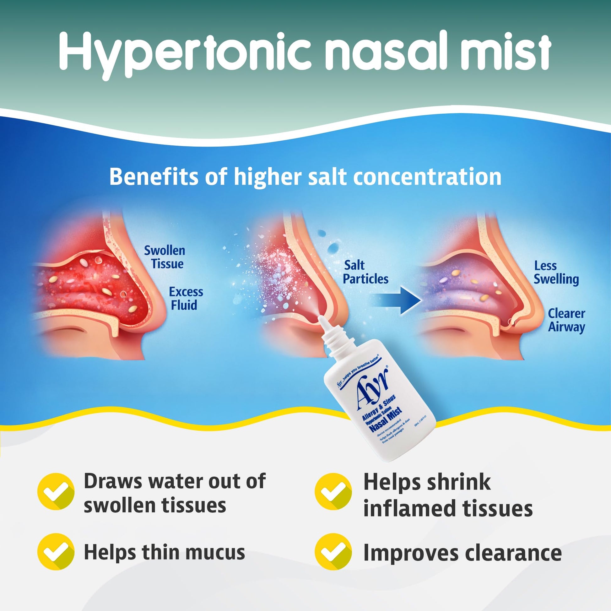AYR allergy and sinus mist spray tip assembly illustration