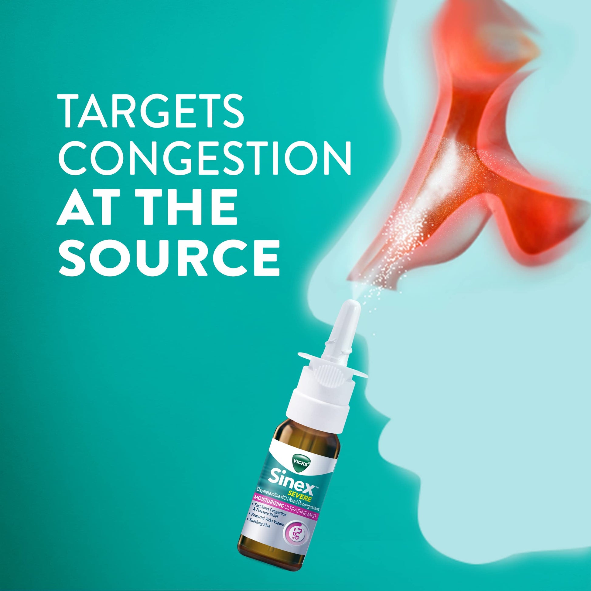 Authentic imported Vicks Sinex Severe Nasal Spray packaging with original American labeling for cold and allergy care