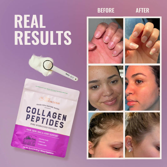 Live Conscious hydrolyzed collagen powder packaging showing Type I and Type III formula details