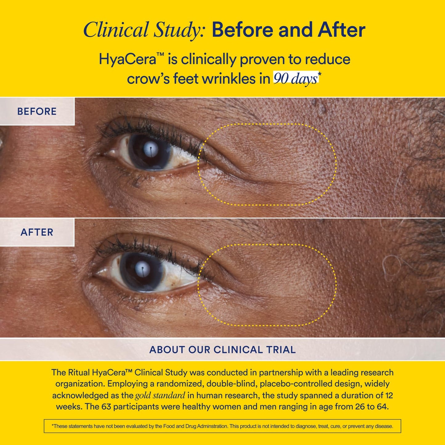 Ritual HyaCera clinically proven wrinkle support packaging