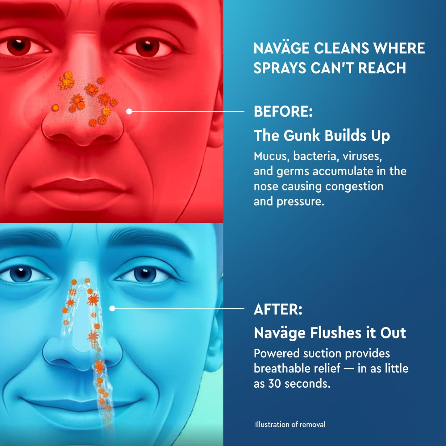 Family set of Navage nose pillows and interchangeable docks