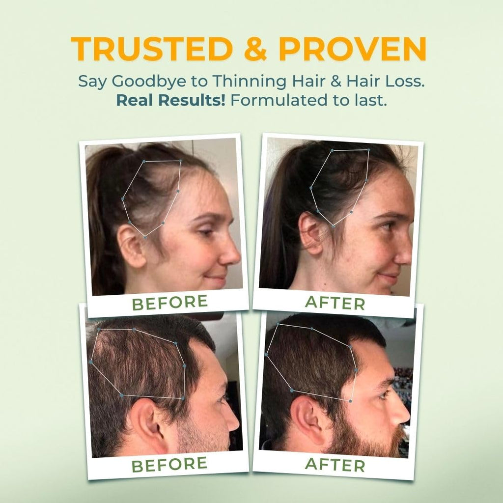 Vital Nutritive Vital Hair Complex capsules close up illustrating daily dosage size