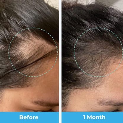 Side view of Baby Blues USA imported hair vitamins for new mothers