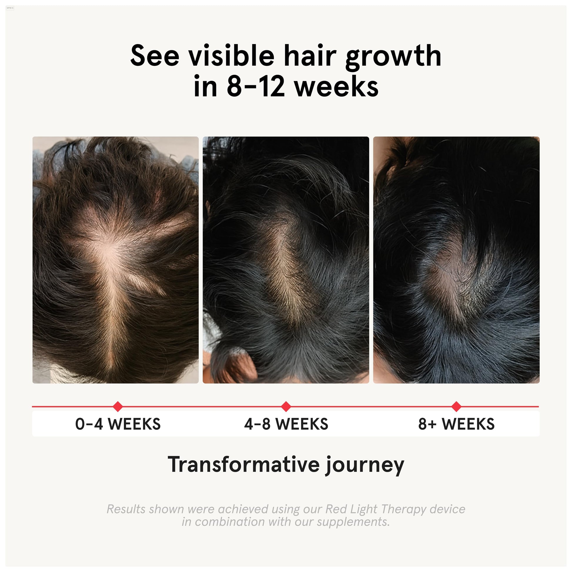 iRestore hair loss vitamins packaging showing high potency biotin and natural DHT blockers label