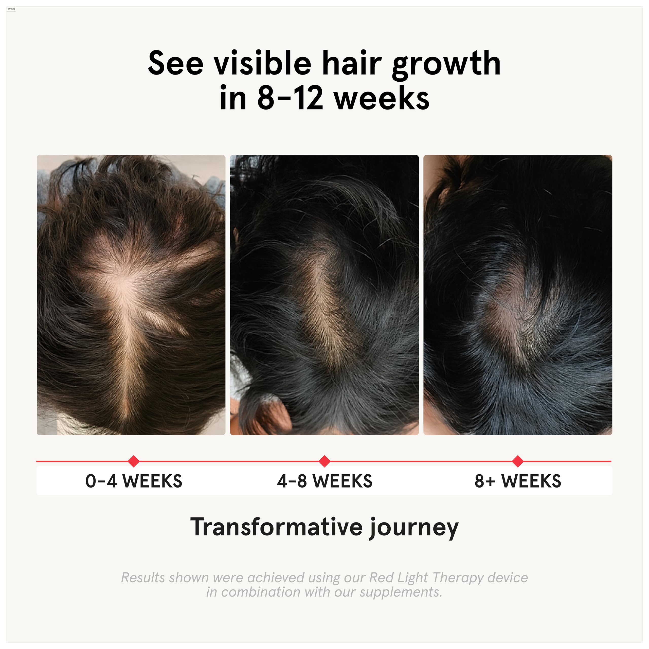 iRestore hair loss vitamins packaging showing high potency biotin and natural DHT blockers label