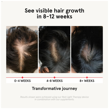 iRestore hair loss vitamins packaging showing high potency biotin and natural DHT blockers label
