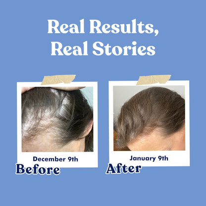 High potency 4 in 1 formula biotin keratin zinc veggie capsules side panel
