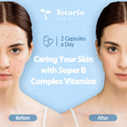 Totaria Health Vitamin B Complex Plus capsules displaying pure plant based dietary supplement benefits