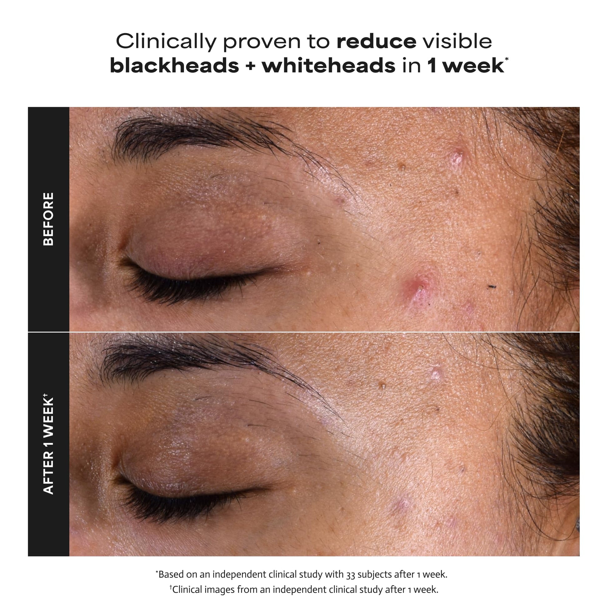 Paula's Choice 118ml Skin Perfecting fluid for enlarged pores and fine lines