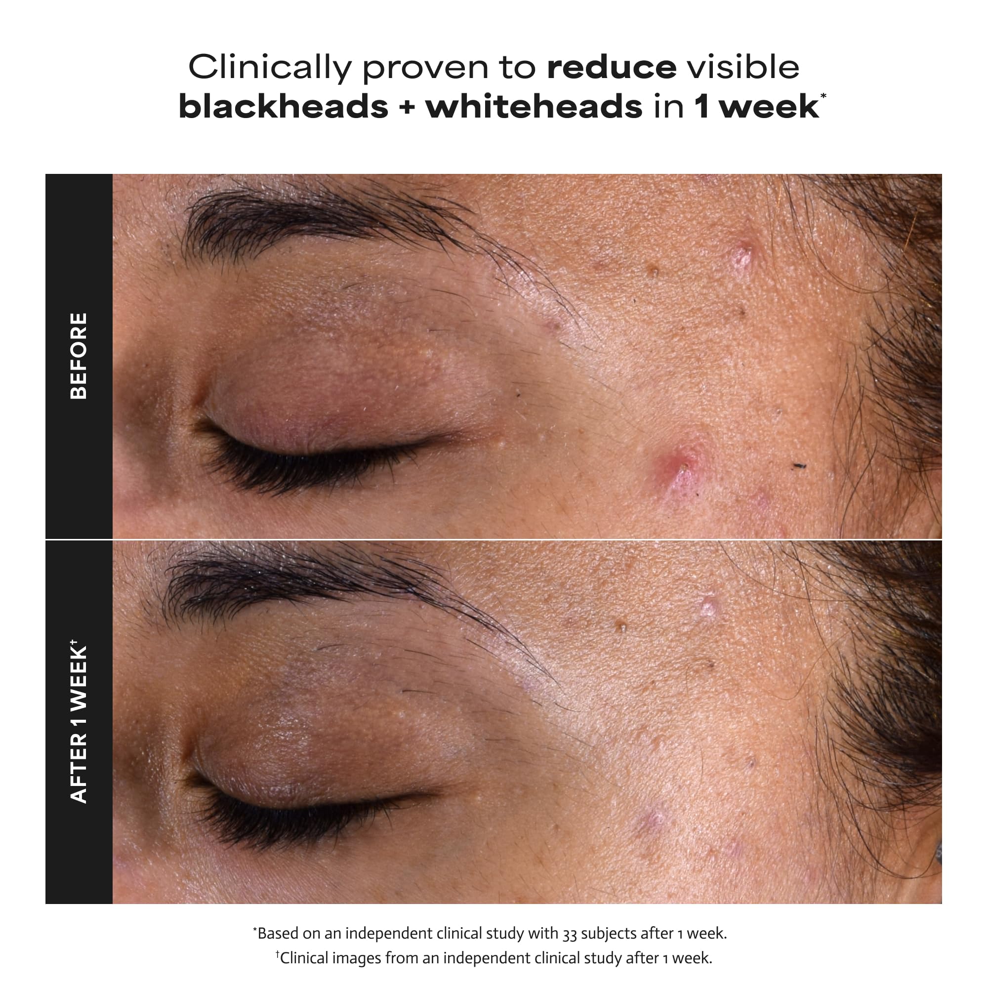 Paula's Choice 118ml Skin Perfecting fluid for enlarged pores and fine lines