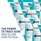 CeraVe 4 percent benzoyl peroxide face wash tube side angle