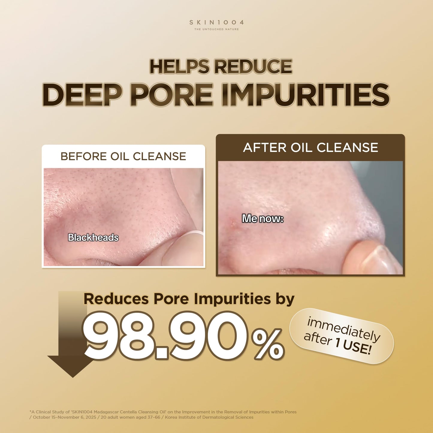 Korean skincare cleanser routine with SKIN1004 oil