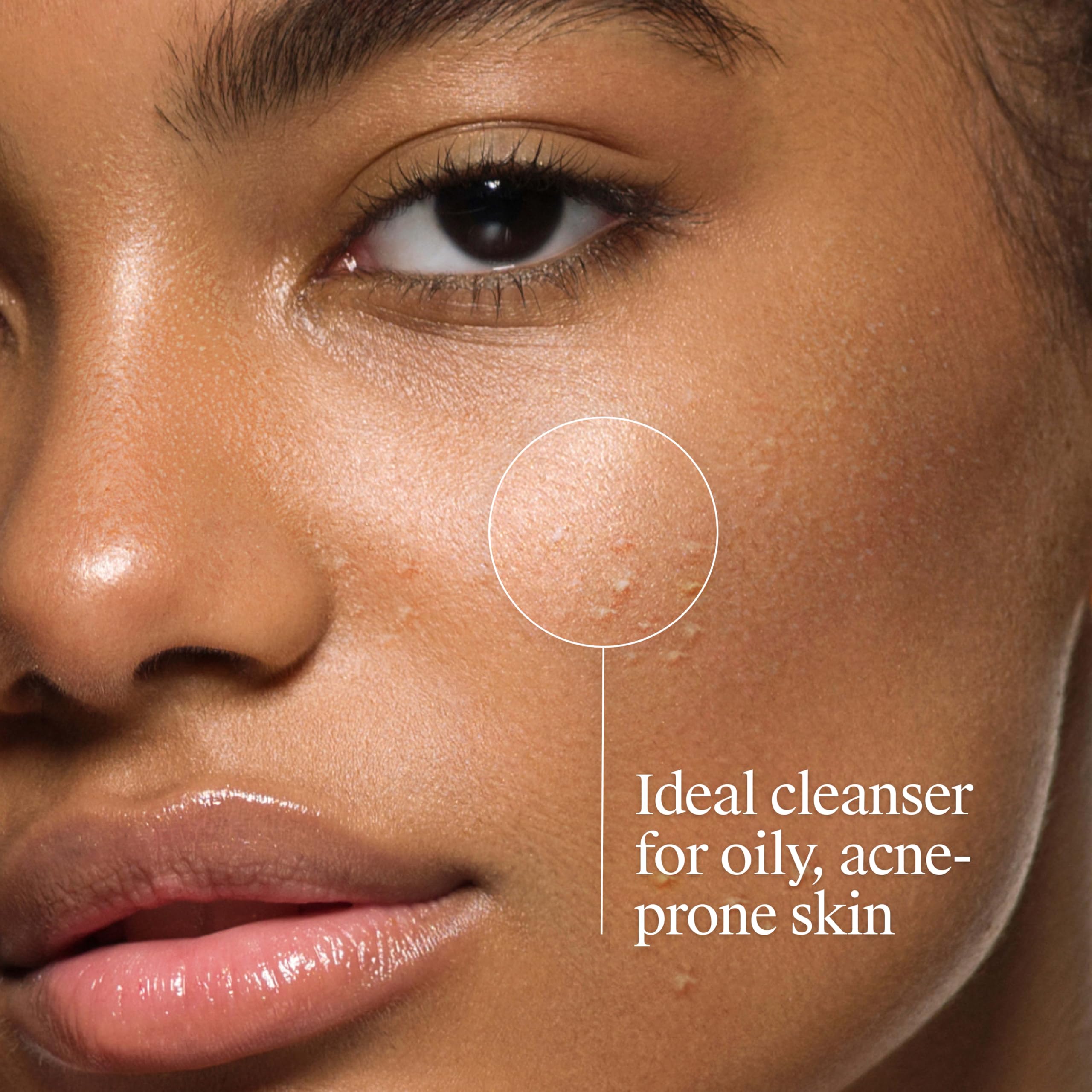 Liquid oil free acne fighting facial cleanser for breakout prone skin