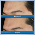 CeraVe skincare product box side highlighting active ingredients