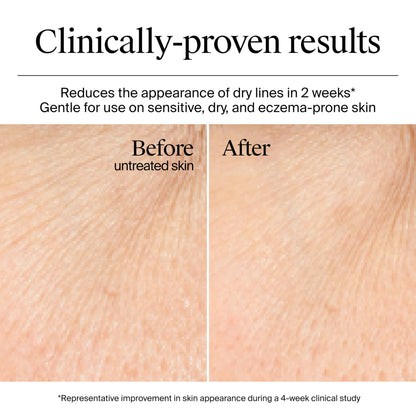 Texture shot of Neutrogena Hydro Boost Gel Cream