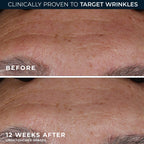 RoC deep wrinkle face treatment side profile of the container