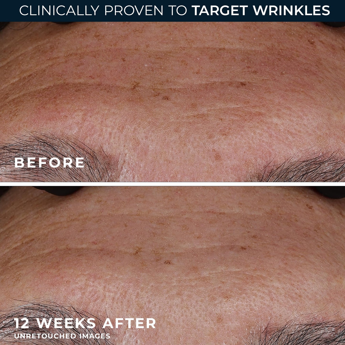 RoC non comedogenic deep wrinkle face and neck serum application