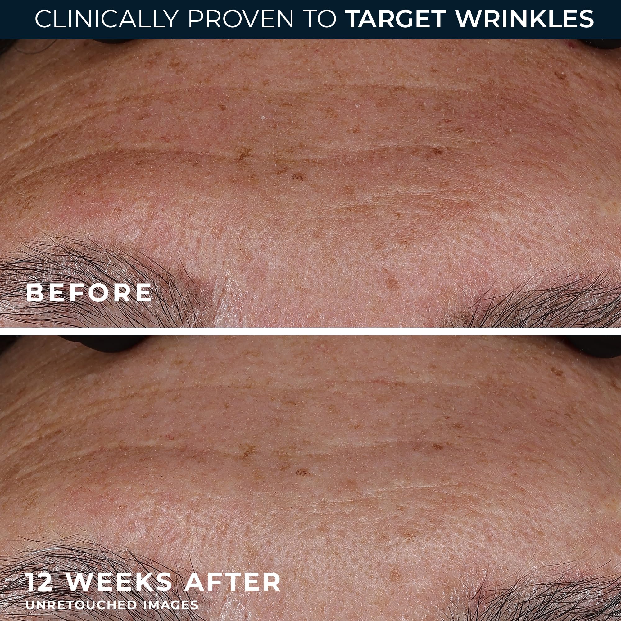 RoC non comedogenic deep wrinkle face and neck serum application