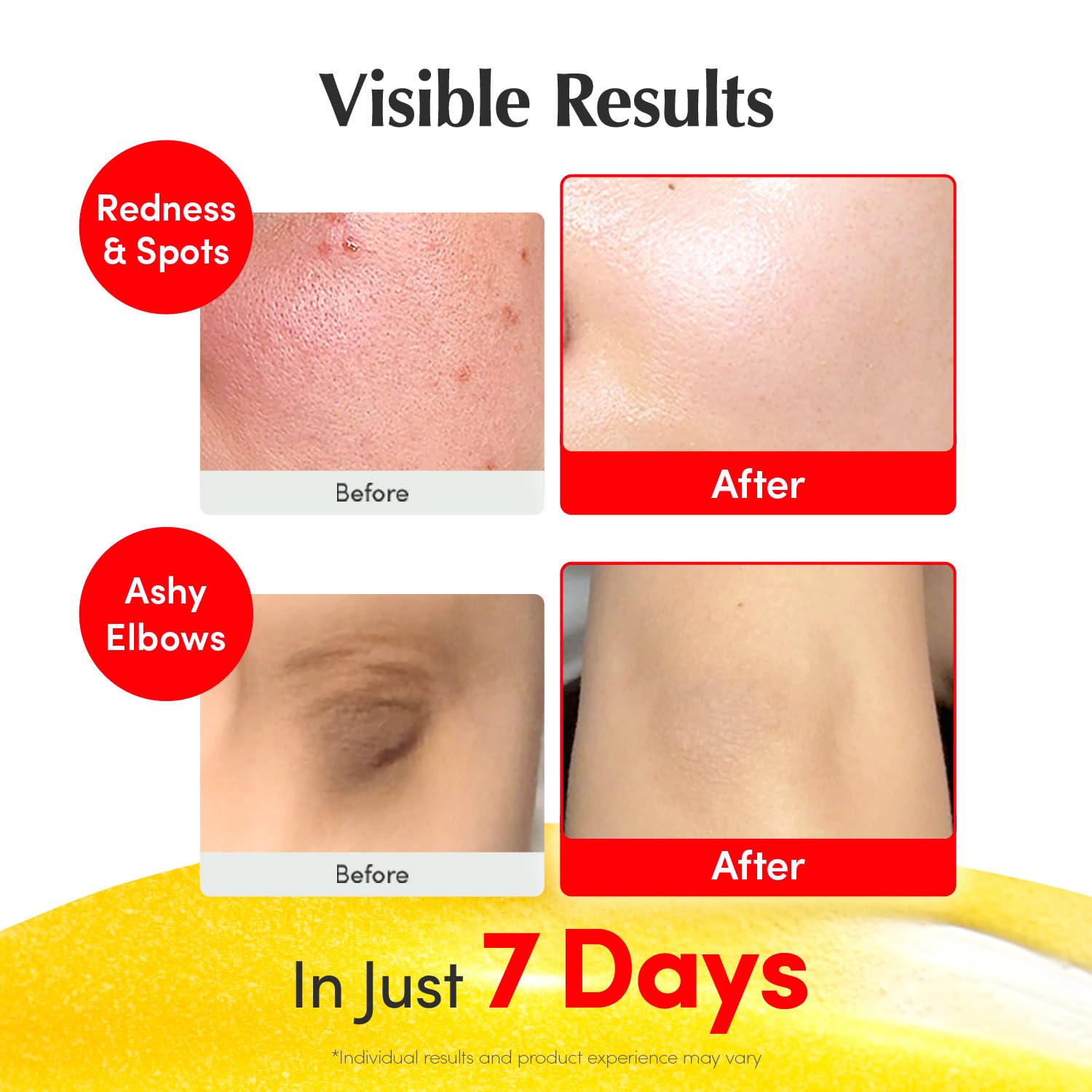 Eqqualberry Vitamin Illuminating Serum dropper application showcasing how to apply the brightening Vitamin C facial serum.