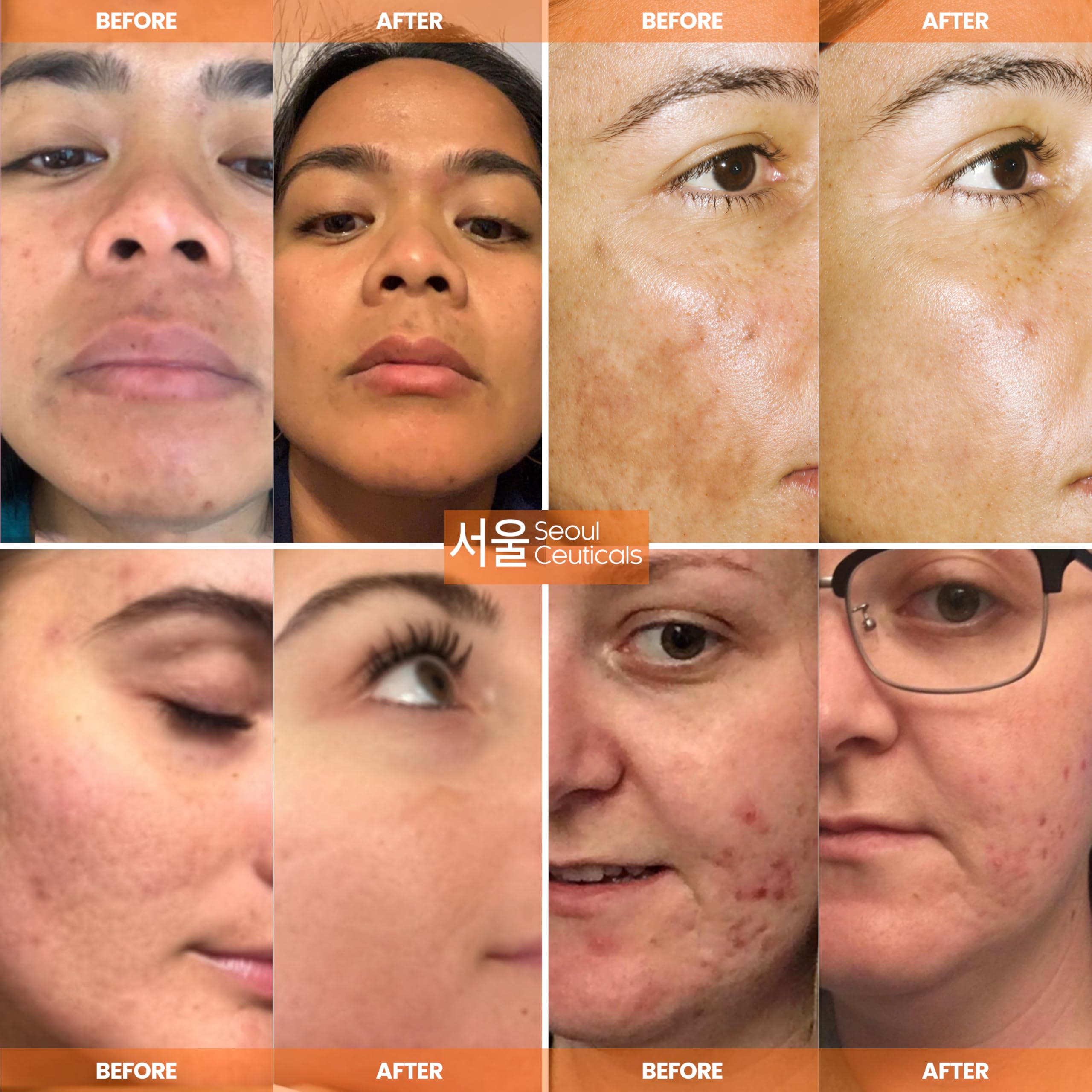 Seoul Ceuticals anti aging serum containing hyaluronic acid and ferulic acid packaging