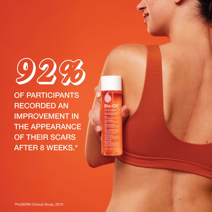 Close up of Bio-Oil label highlighting Vitamin A and Vitamin E