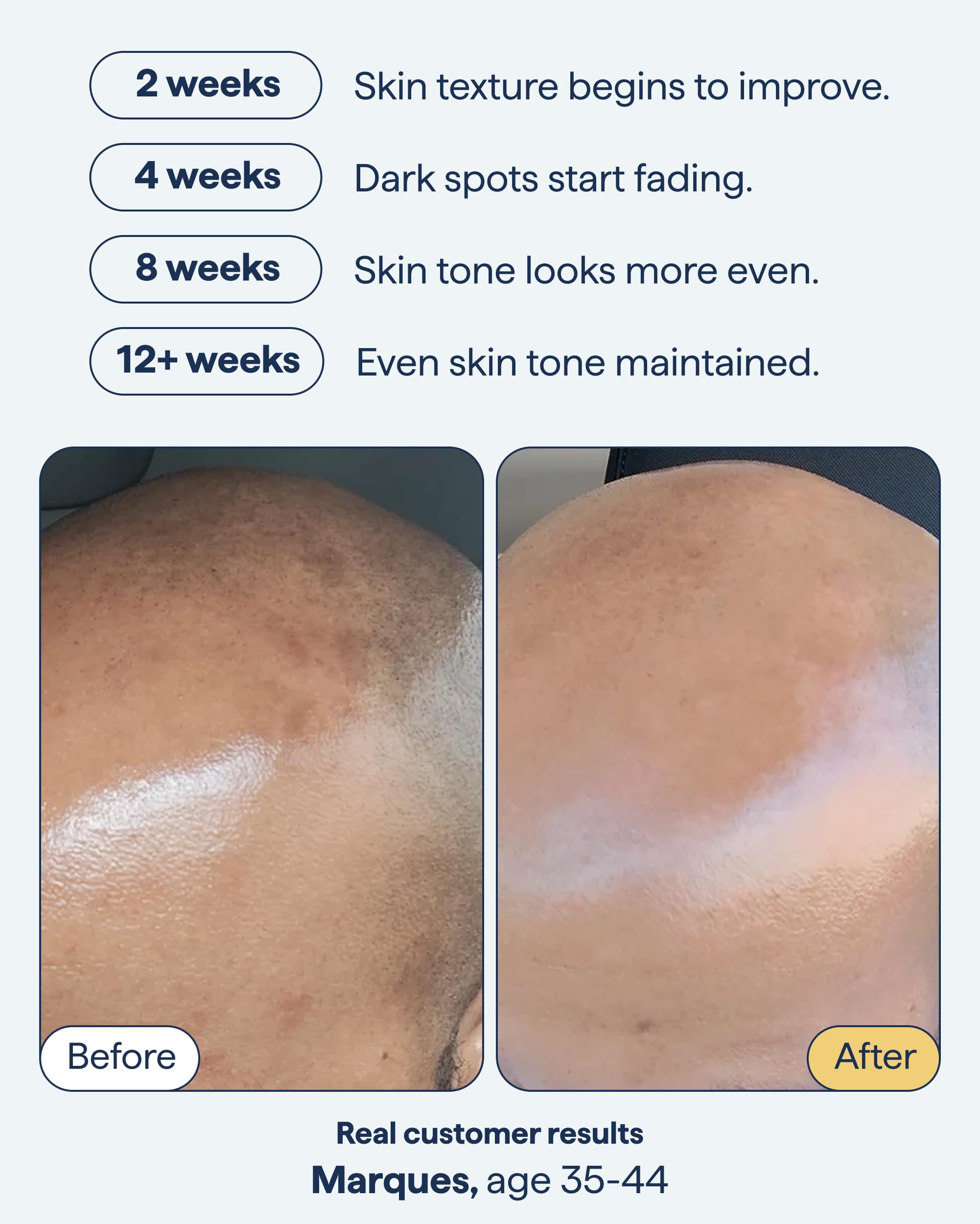Texture shot of Remedy Science discoloration night treatment gel lotion on a white background
