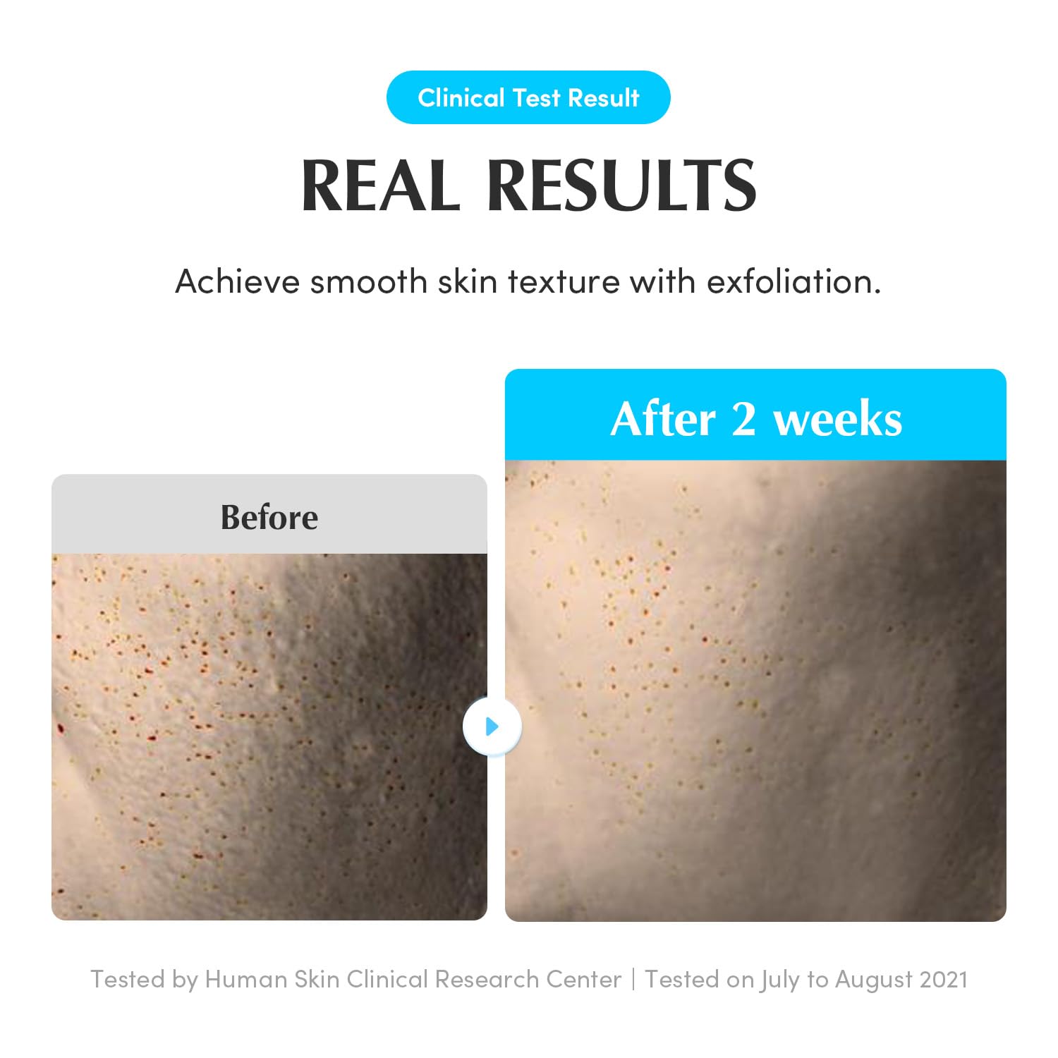 Natural 5-berry complex brightening Korean skincare toner packaging details