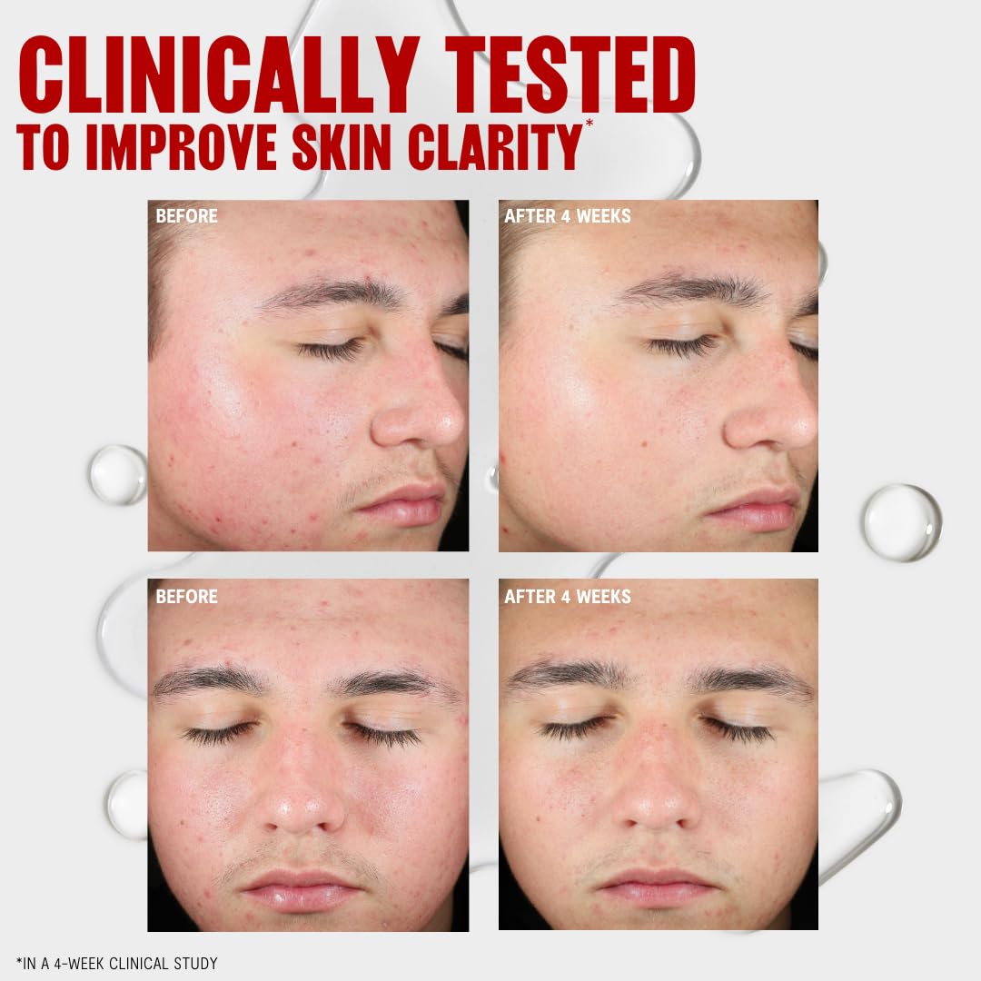 Thayers Blemish Clearing Toner texture and application