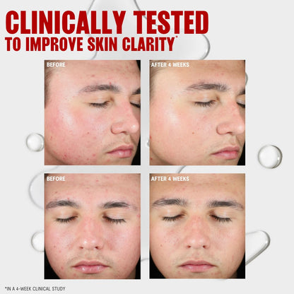 Thayers Blemish Clearing Toner texture and application