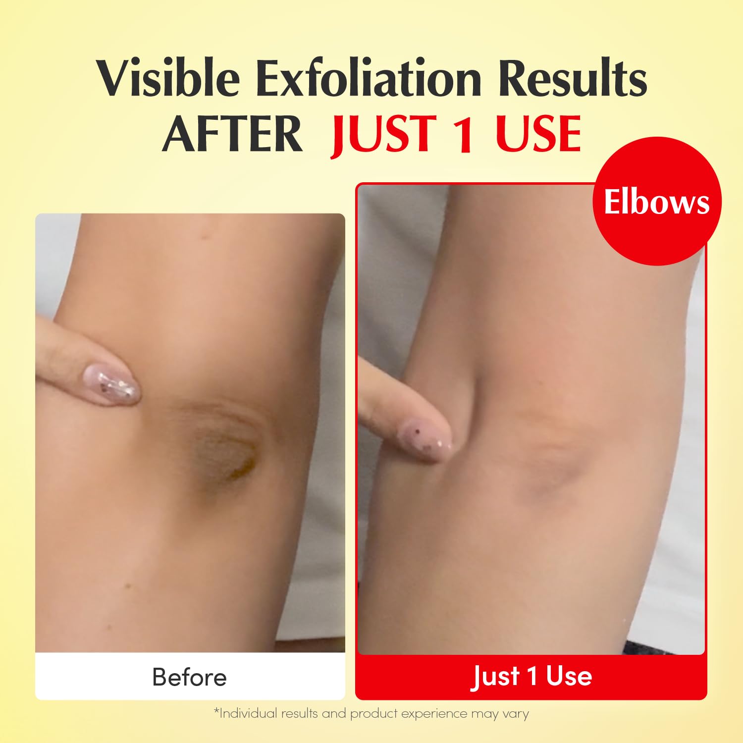 EQQUALBERRY Acerola water skincare toner for achieving glowing Indian skin