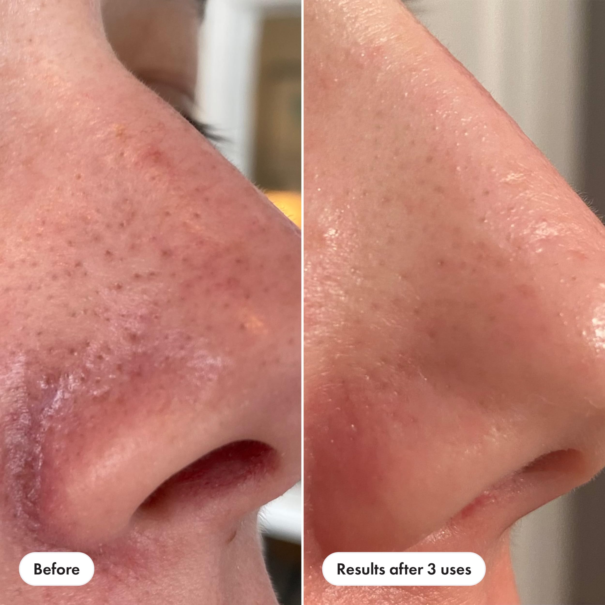 Hero Cosmetics Pore Release BHA PHA AHA toner texture liquid being poured out for application