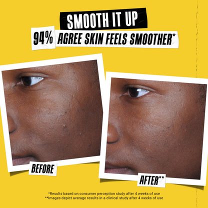 Kiehl's Better Screen UV Serum application on skin