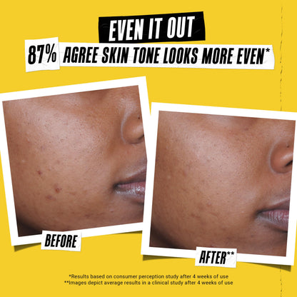 Side profile of Kiehl's Better Screen UV Serum bottle