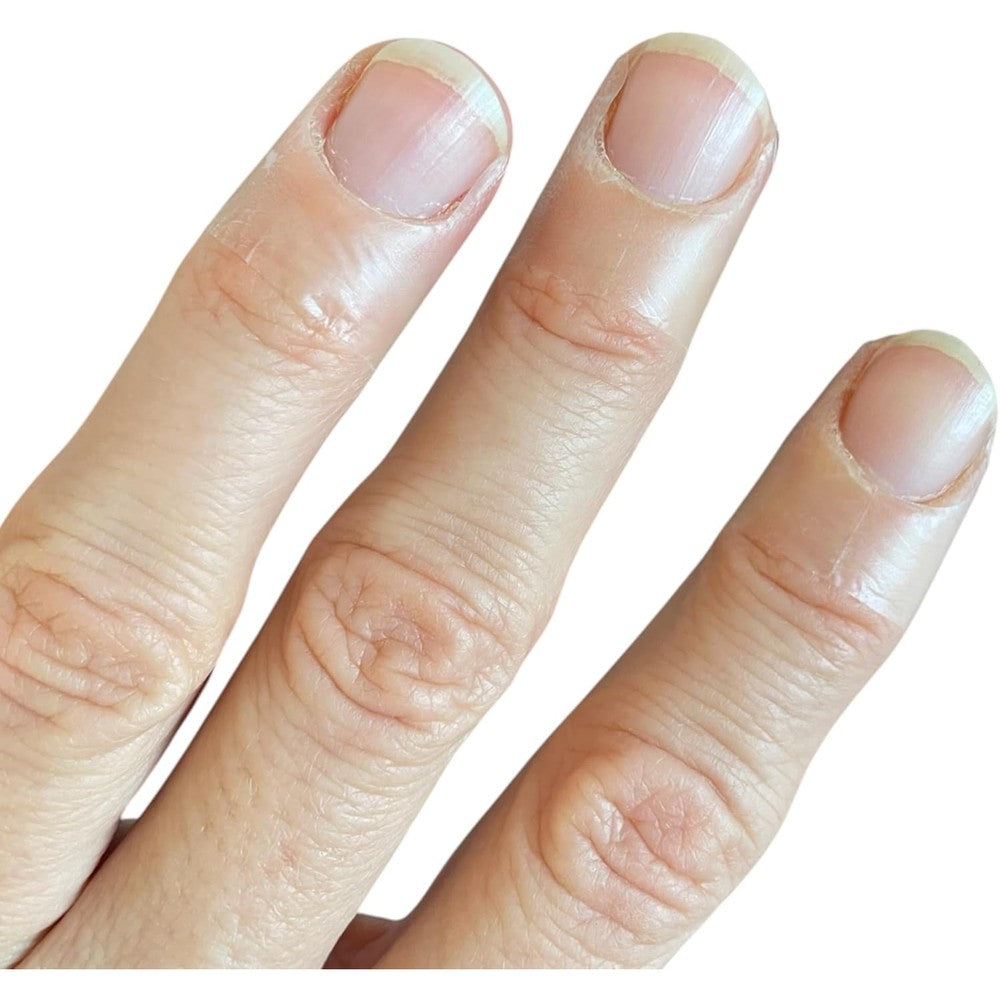 Chalmery Cuticle Skin Covers Medium front view packaging showing transparent protective finger patches