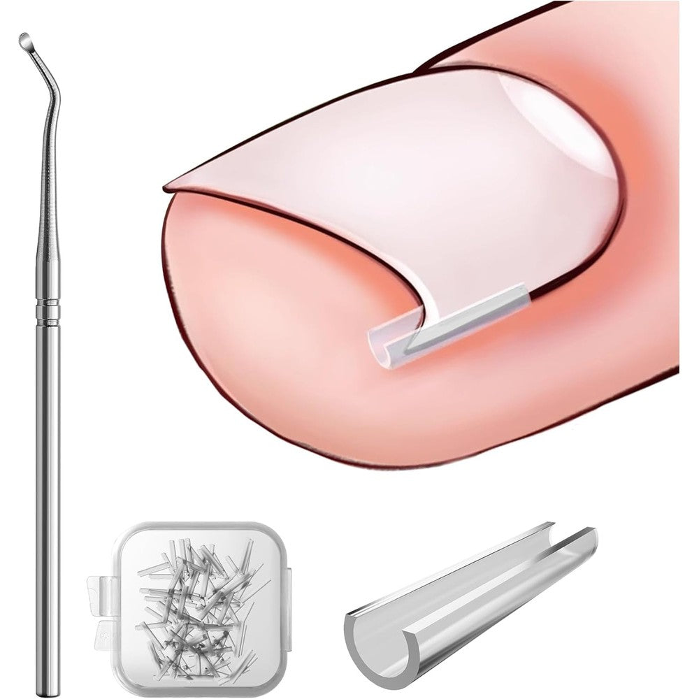 Bezox Ingrown Toenail Corrector Set front view with box and tools.