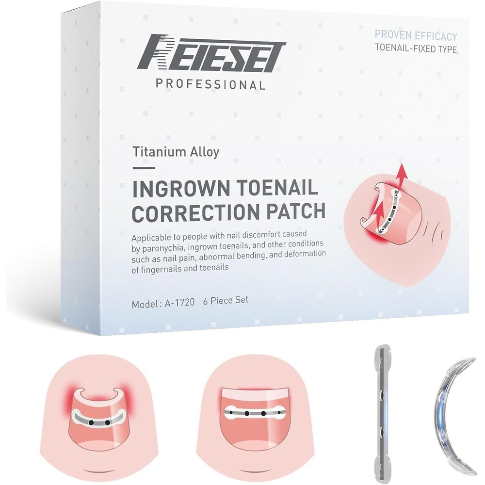 Reieset titanium alloy ingrown toenail treatment kit front view