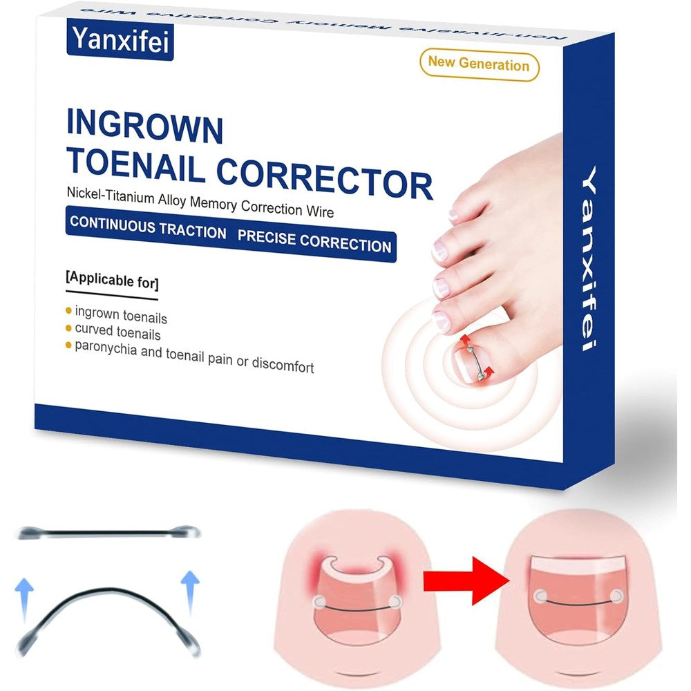 Yanxifei Nitinol Ingrown Toenail Corrector Kit front view