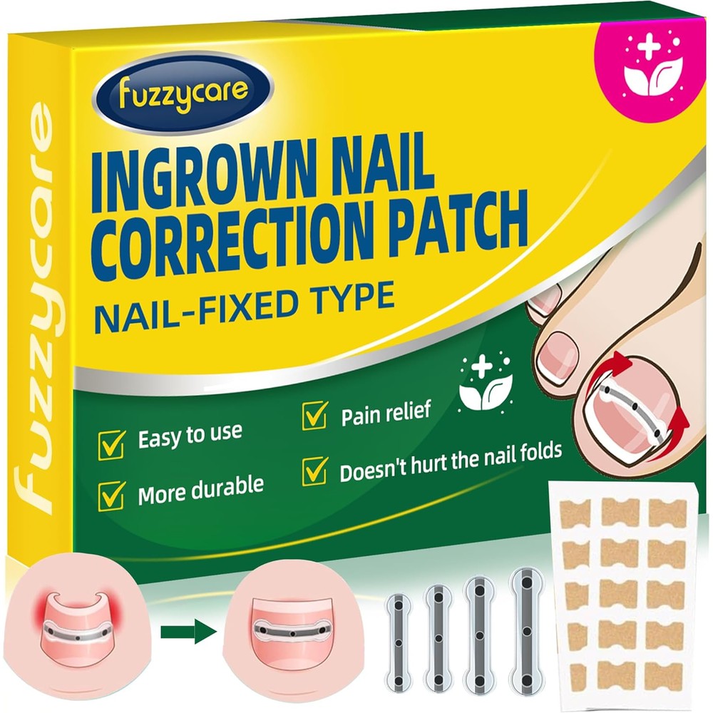 Fuzzycare titanium alloy ingrown toenail treatment kit front view