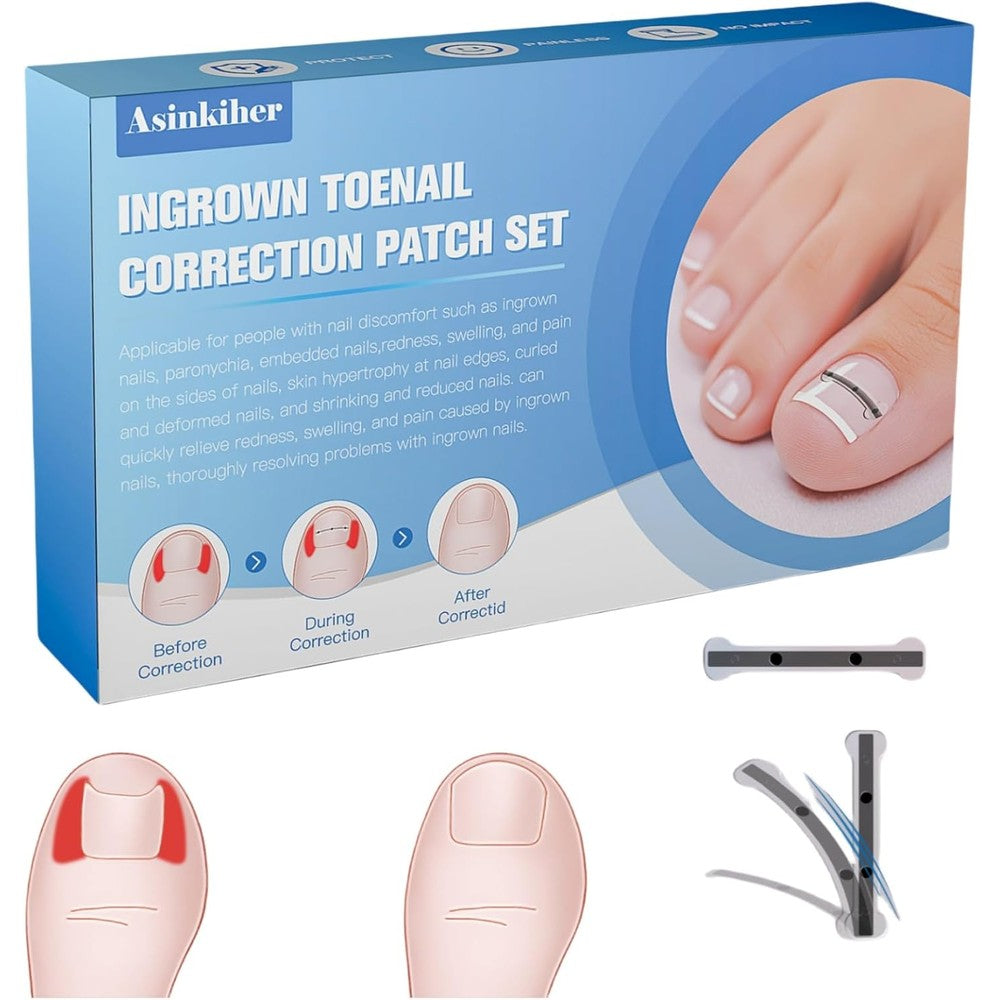Asinkiher Titanium Alloy Ingrown Toenail Treatment Kit front view