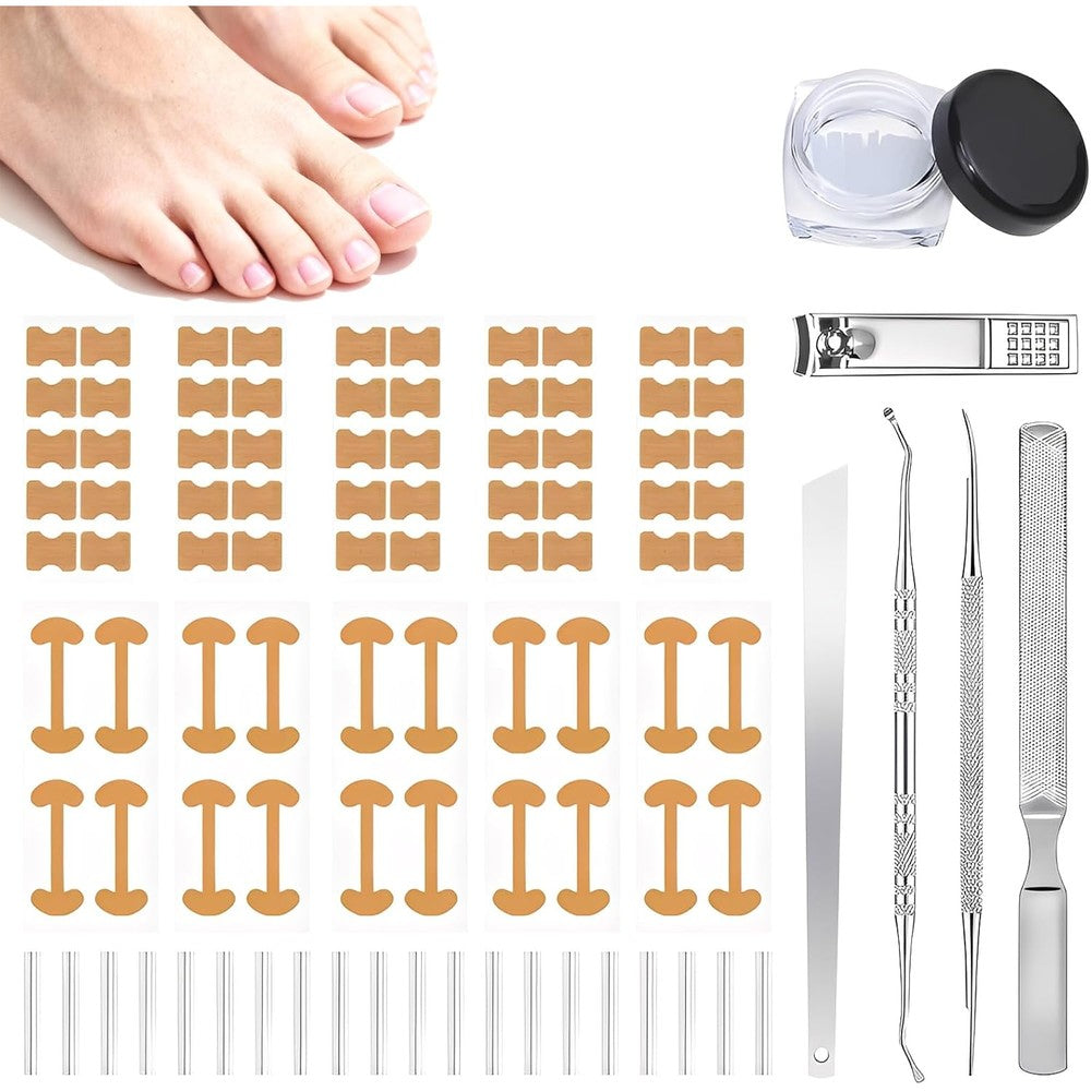 LYNRUI ingrown toenail corrector set front view showing complete sixteen piece silver kit with adhesive patches and steel tools