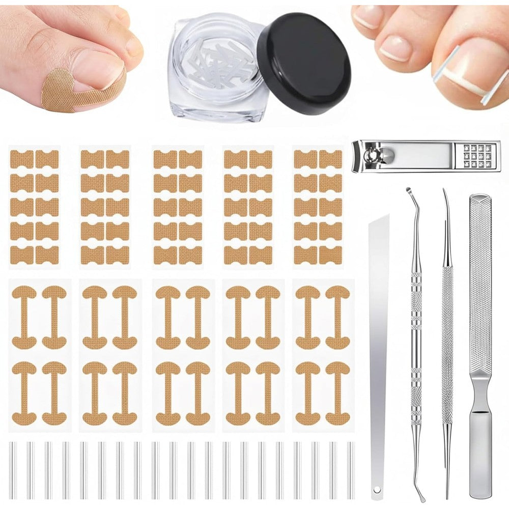 Callmynm Ingrown Toenail Corrector Set front view showing the full professional pedicure tool kit and adhesive correction patches.