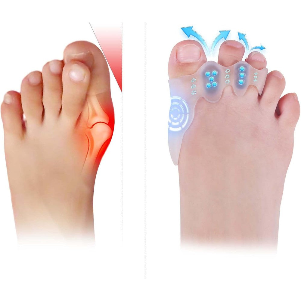 Tevezo kids toe spacers and bunion corrector front view