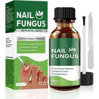 Noxyral Toenail Fungus Treatment Extra Strength front view bottle.