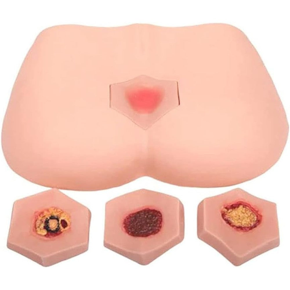 LUCKFY Decubitus Ulcer Training Model front view for medical wound care.