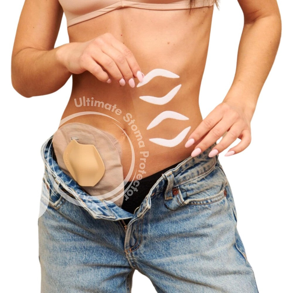 SIIL Stoma Protector front view showing the protective dome shield for ostomy bags.