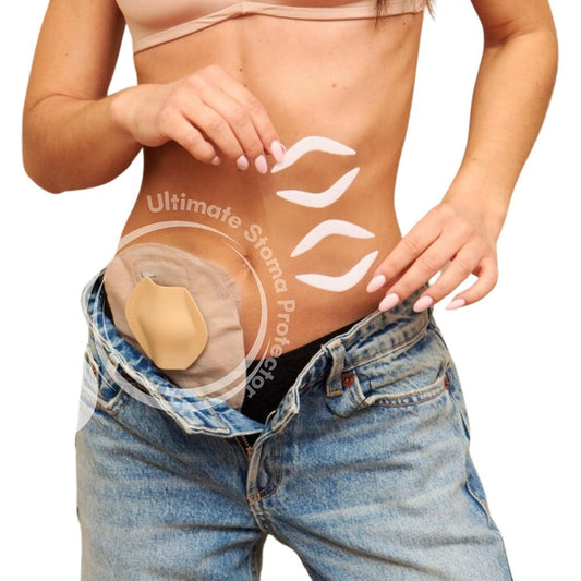 SIIL Stoma Protector front view showing the protective dome shield for ostomy bags.
